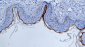 Filaggrin-1